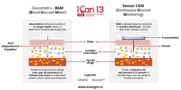 Comparație BGM vs CGM - monitorizare glicemie iCan